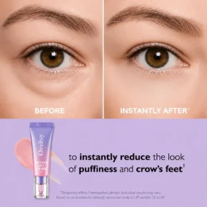 Ovelisy® Eye Bag Instant Eraser