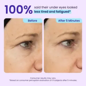 Ovelisy® Eye Bag Instant Eraser