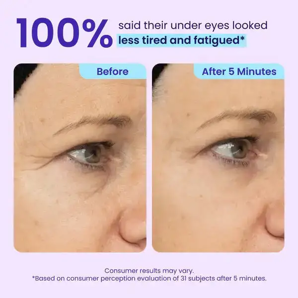 Ovelisy® Eye Bag Instant Eraser
