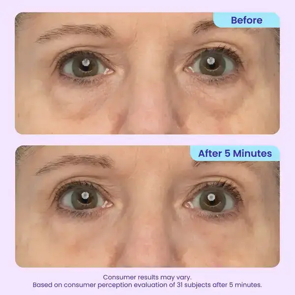 Ovelisy® Eye Bag Instant Eraser