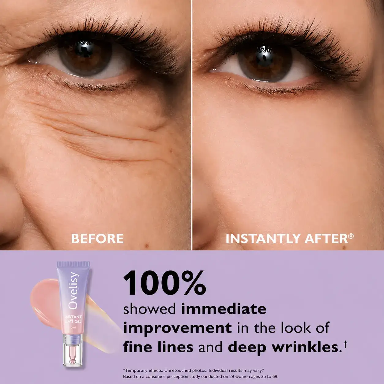 Ovelisy® Eye Bag Instant Eraser