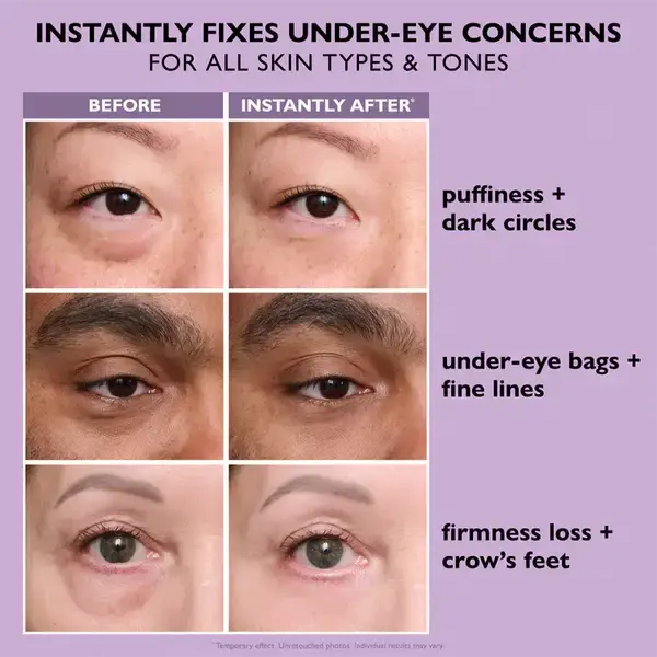 Ovelisy® Eye Bag Instant Eraser